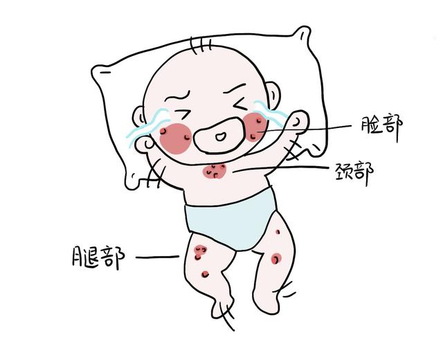 首页 产妇月子餐 正文(1)室内温度,湿度对婴儿湿疹的发病有一定的